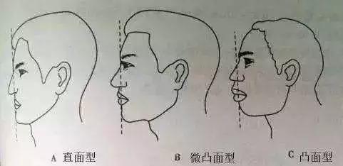 凸嘴整形方法（做好表情管理比化妆修饰效果更好）(3)