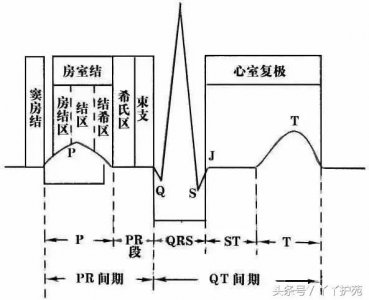 ​自己怎么看懂心电图（这样教你看心电图）