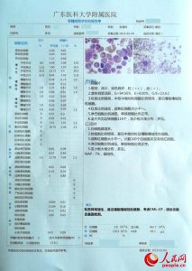 ​慢粒白血病 早期无症状？带你了解慢性粒细胞白血病的“三期”