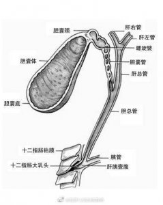 ​切除胆囊有后遗症吗? 切除胆囊有什么后遗症吗