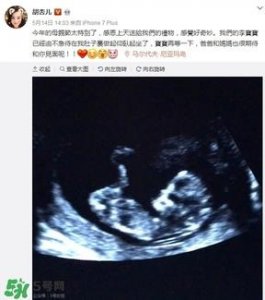 ​黄宗泽恭喜胡杏儿怀孕 胡杏儿黄宗泽为什么分手